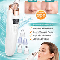 5 in 1 Blackhead Remover Vacuum – Rechargeable Pore Cleaner Machine for Acne & Deep Skin Cleaning (Price in Pakistan)